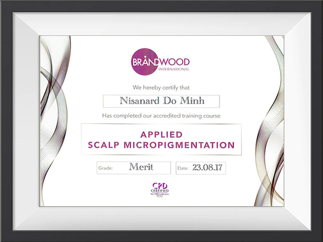 “Applied Scalp Micropigmentation”,Brandwood Clinic,🇬🇧 Solihull, UK
