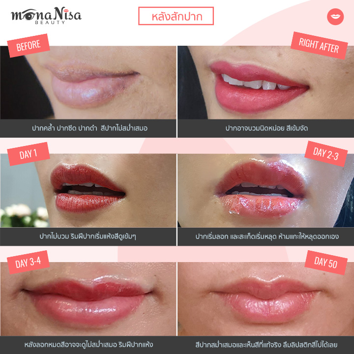 หลังสักปาก