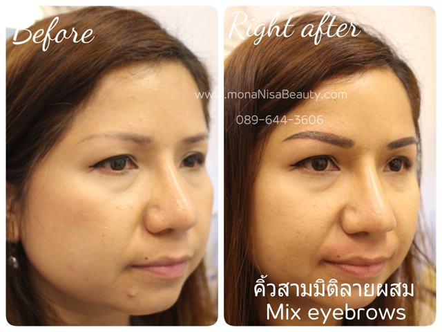 คิ้วสามมิติแบบผสม