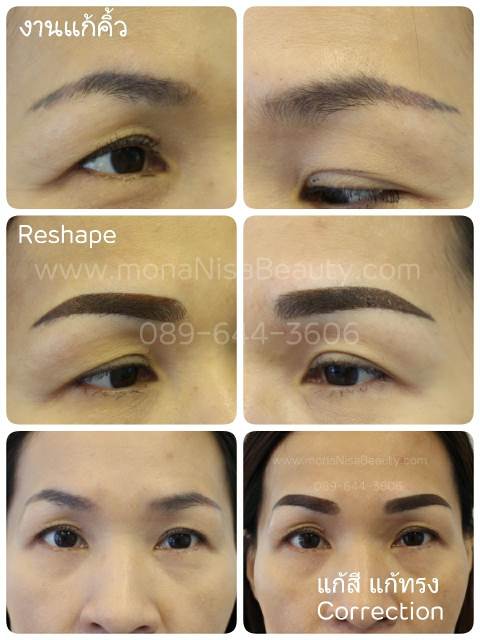 ลบรอยสักคิ้ว ตา ปาก