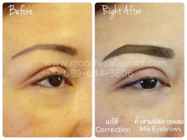 ลบรอยสักคิ้ว ตา ปาก