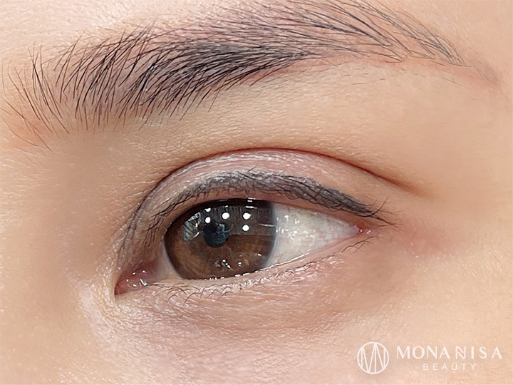 ขอบตาหลังลอก 1 เดือน เครื่องมือพรีเมี่ยมโดยอาจารย์นิซ่า